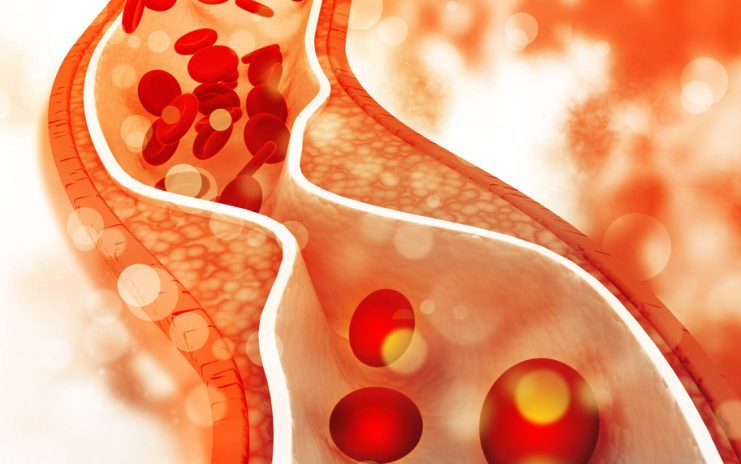 ٩-خطوات-لتحسين-نسبة-الكولسترول-في-الدم-دون-الستاتين